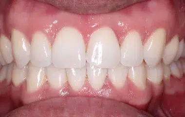 after wong wired orthodontics