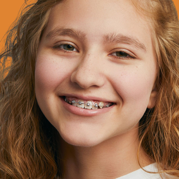 affordable braces in austin tx wired orthodontics